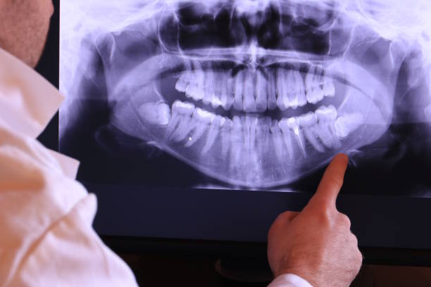 Best Emergency Gum Treatment in Onsted, MI