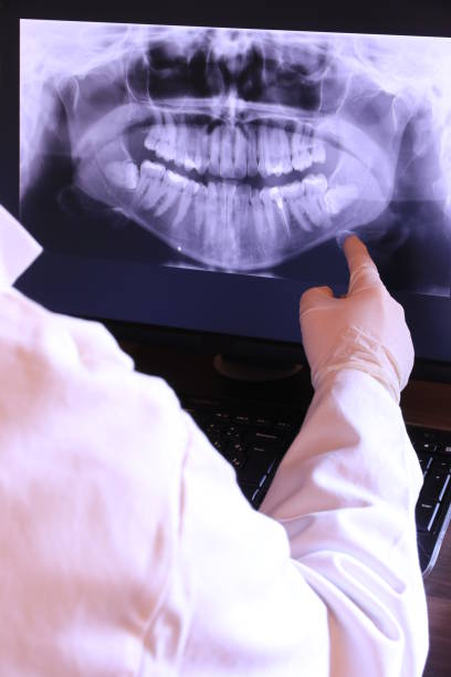 Best Emergency Dental Care for Broken or Chipped Teeth in Onsted, MI