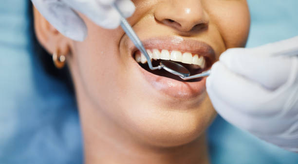Best Emergency Tooth Extraction in Onsted, MI