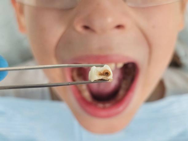 Best Emergency TMJ Treatment in Onsted, MI